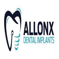 all On X Dental Implants
